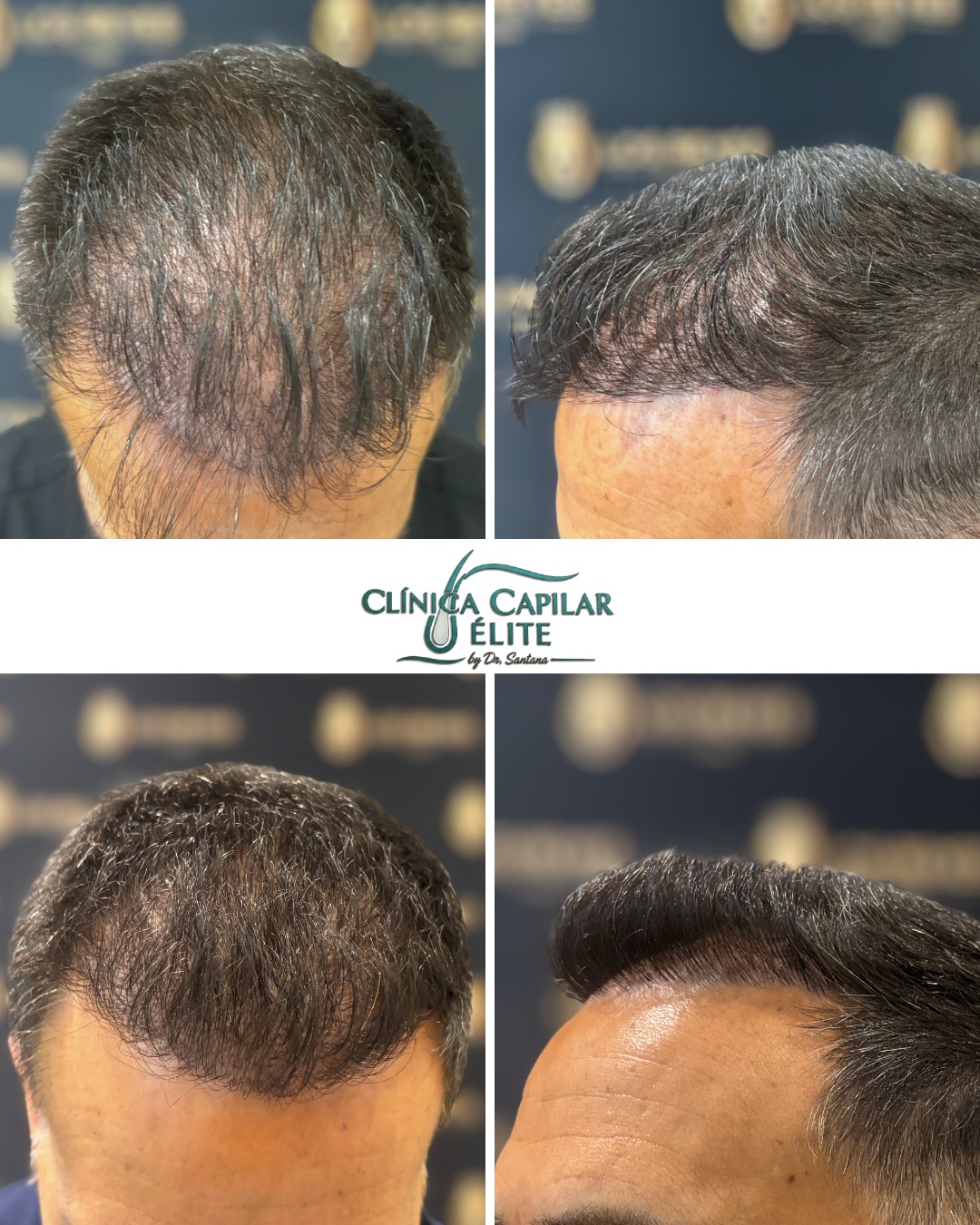 Diagnóstico Capilar