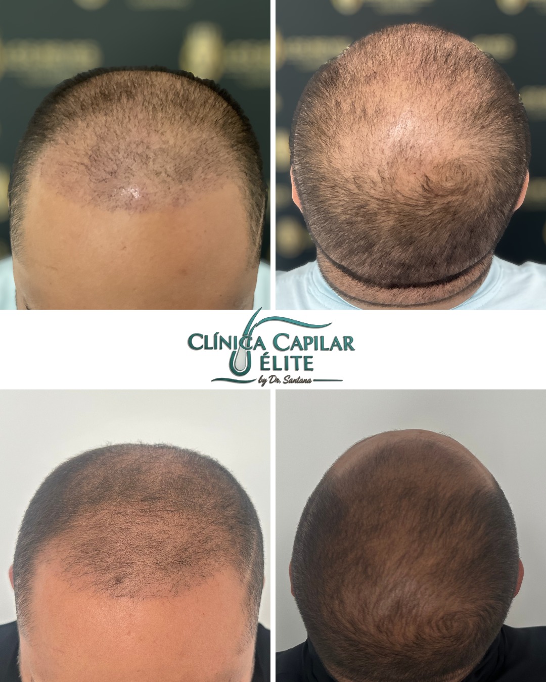 Diagnóstico Capilar