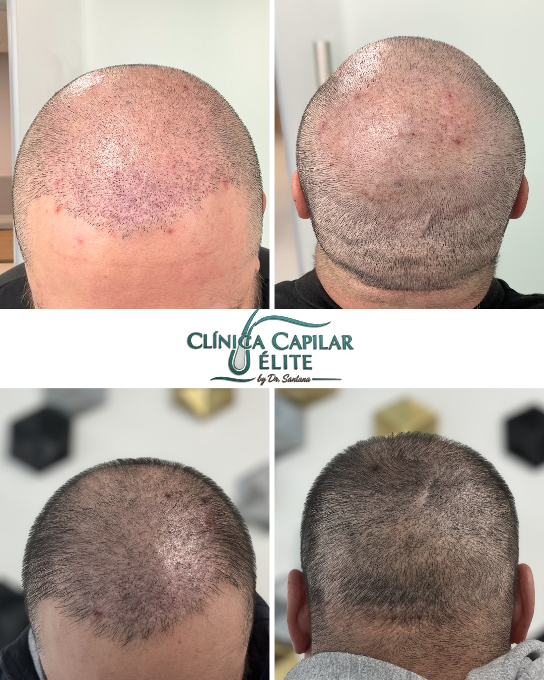 Diagnóstico Capilar